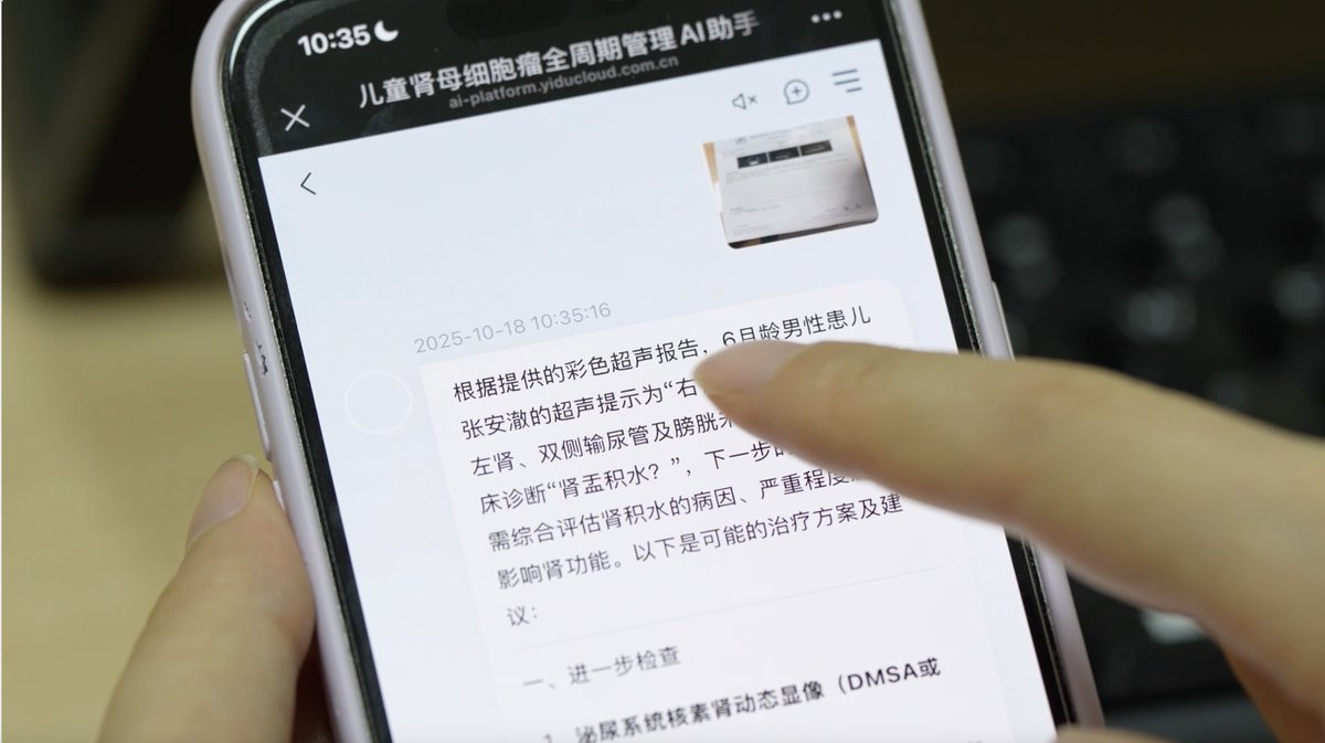 Çin'de Bir Hastane, Nadir Görülen Çocukluk Çağı Böbrek Kanseri İçin Yapay Zeka Asistanı Geliştirdi