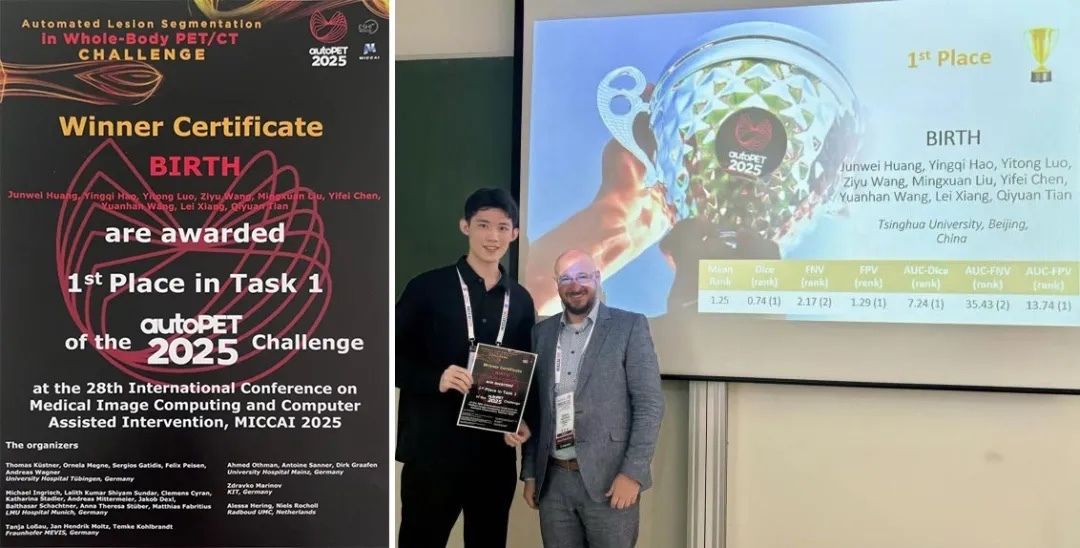 Tsinghua Üniversitesi Öğrencileri, Yapay Zeka Tümör Segmentasyonunda Dünya Şampiyonu Oldu